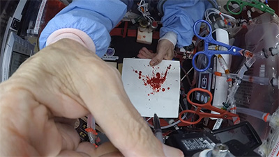 bloodstain patterns being recreated in reduced gravity aboard a parabolic aircraft 