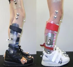 Two lower legs fitted with complex ankle-foot orthoses over black and white shoes.