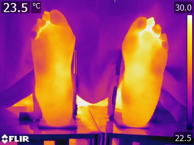 Thermal image of two feet with bright yellow soles and a temperature scale from 22.5 to 30°C.