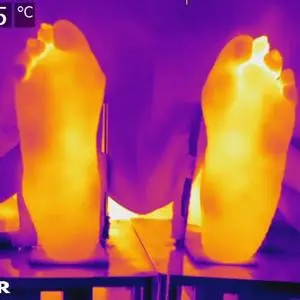 Thermal image of two feet with bright yellow soles and a temperature scale from 22.5 to 30°C.